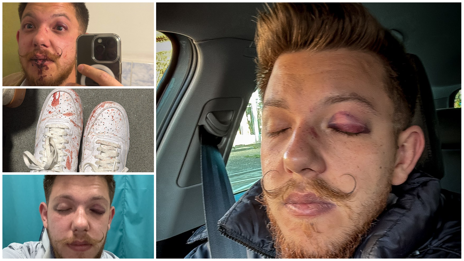 Utcai verekedés Sepsiszentgyörgyön: egymást vádolja a Sepsi OSK két edzője és egy fiatal